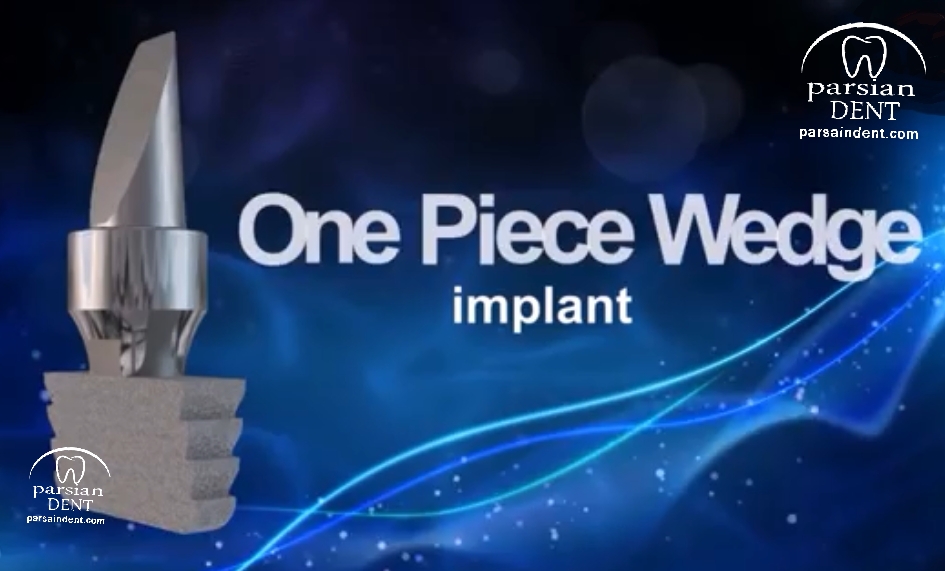 ایمپلنت وج ، راه حلی برای استخوانهای تحلیل رفته