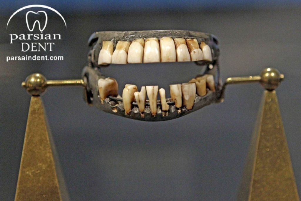 تاریخچه دندان مصنوعی