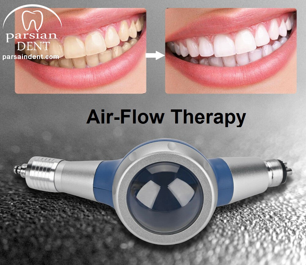 جرمگیری دندان با ایرفلو روشی نوین در دندانپزشکی
