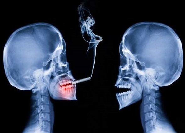 دخانیات و سلامت دهان و دندان