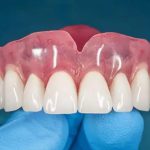 مراقبت-از-دندان-مصنوعی-همه-بایدها-و-نبایدهایی-که-باید-بدانید