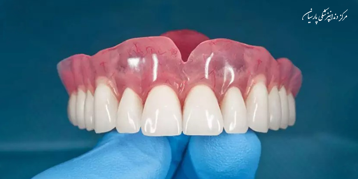 مراقبت-از-دندان-مصنوعی-همه-بایدها-و-نبایدهایی-که-باید-بدانید