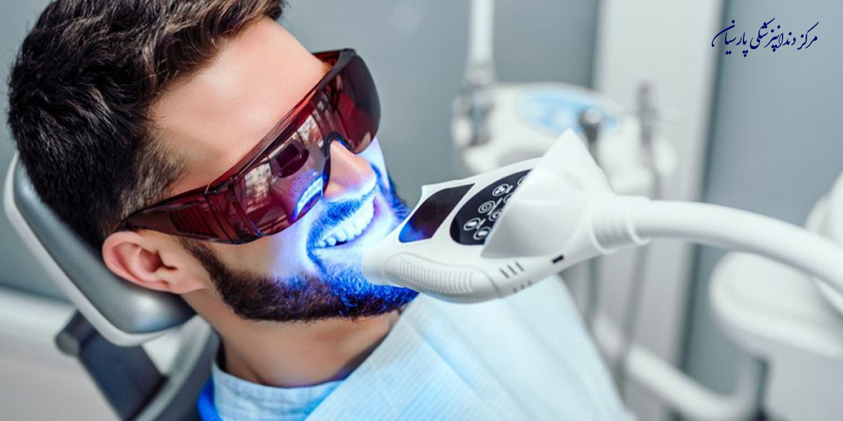 مراقبت-بعد-از-بلیچینگ-دندان-بایدها-و-نبایدهایی-که-لازم-است-بدانید