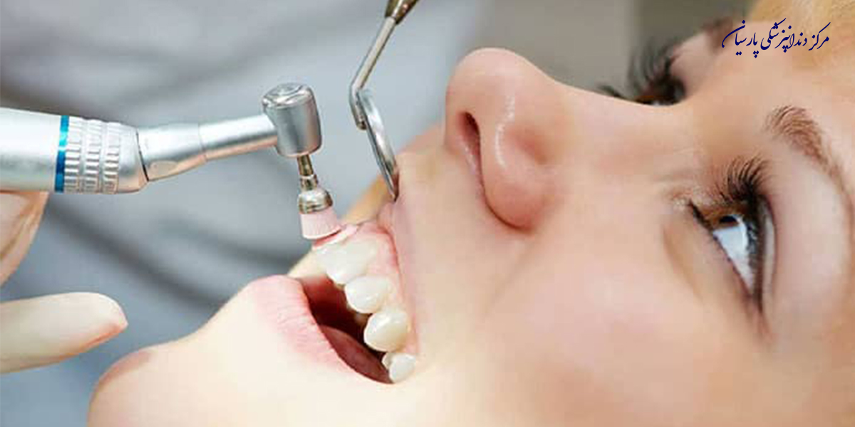 مراقبت-بعد-از-جرمگیری-دندان-بایدها-و-نبایدهای-که-باید-بدانید