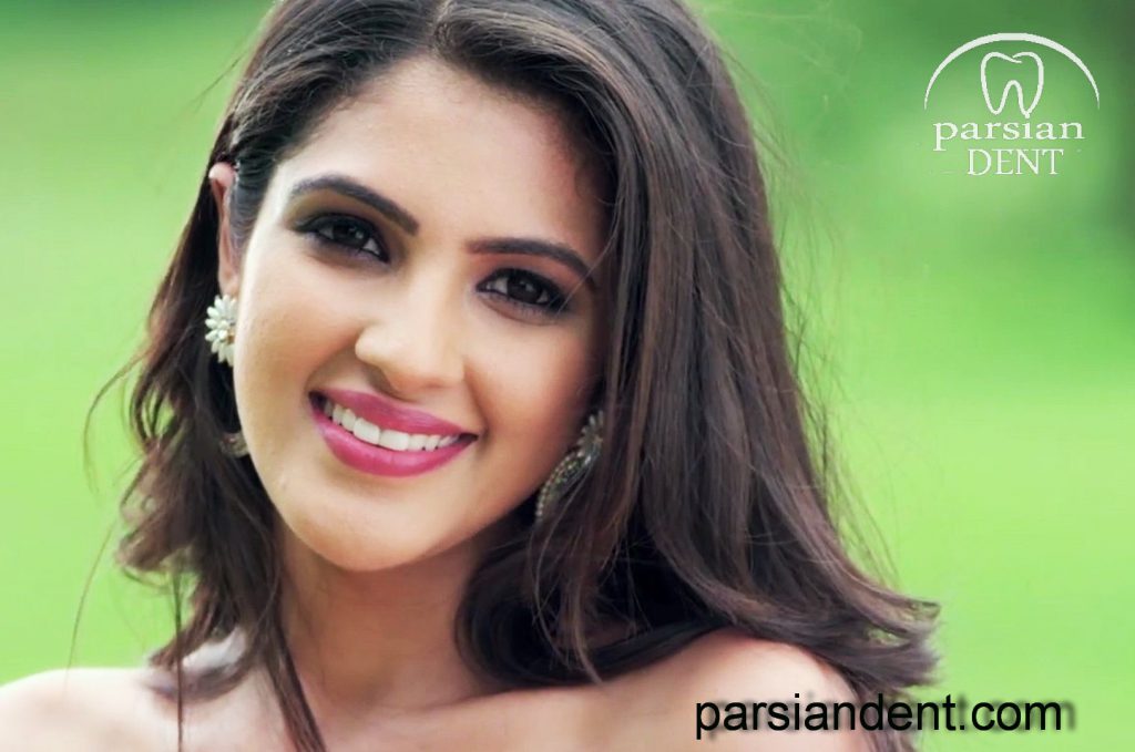 مراقبت‌‌‏های بعد از انجام کامپوزیت ونیر