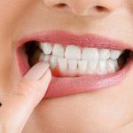 نکات-طلایی-که-باید-از-مراقبت-بعد-از-جراحی-لثه-بدانید