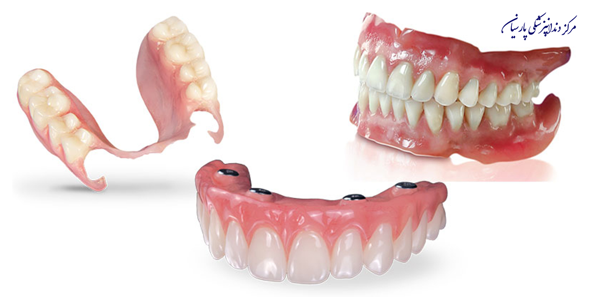 همه-چیز-در-رابطه-با-مراقبت-از-دندان-مصنوعی