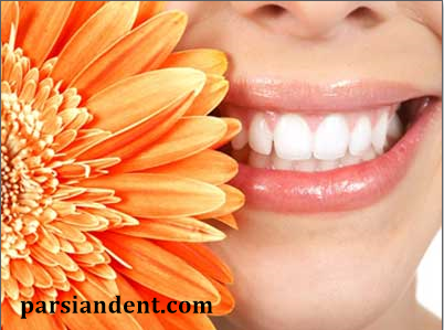 چگونه لمینت دندان زیباتری داشته باشیم ؟