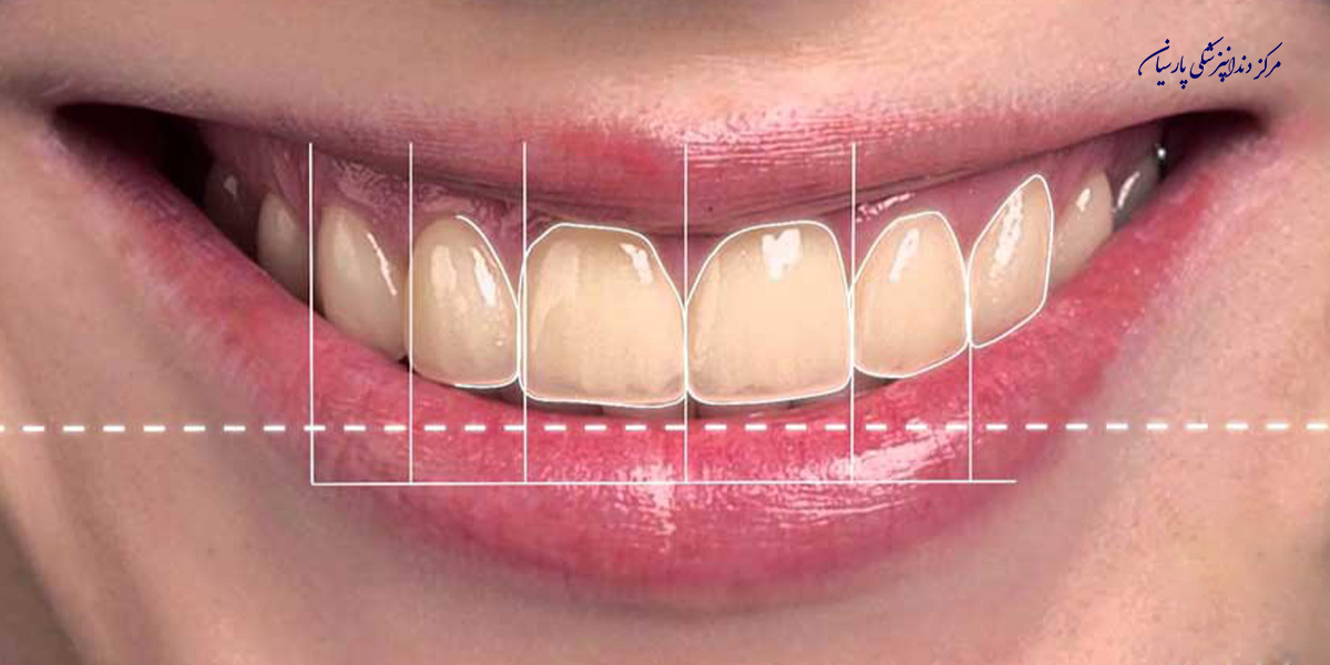 بایدها و نبایدهایی از طرح لبخند که باید بدانید