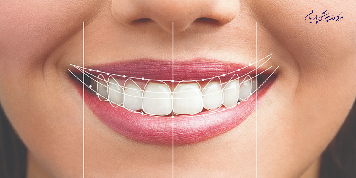 طرح لبخند شامل چه مواردی است ؟