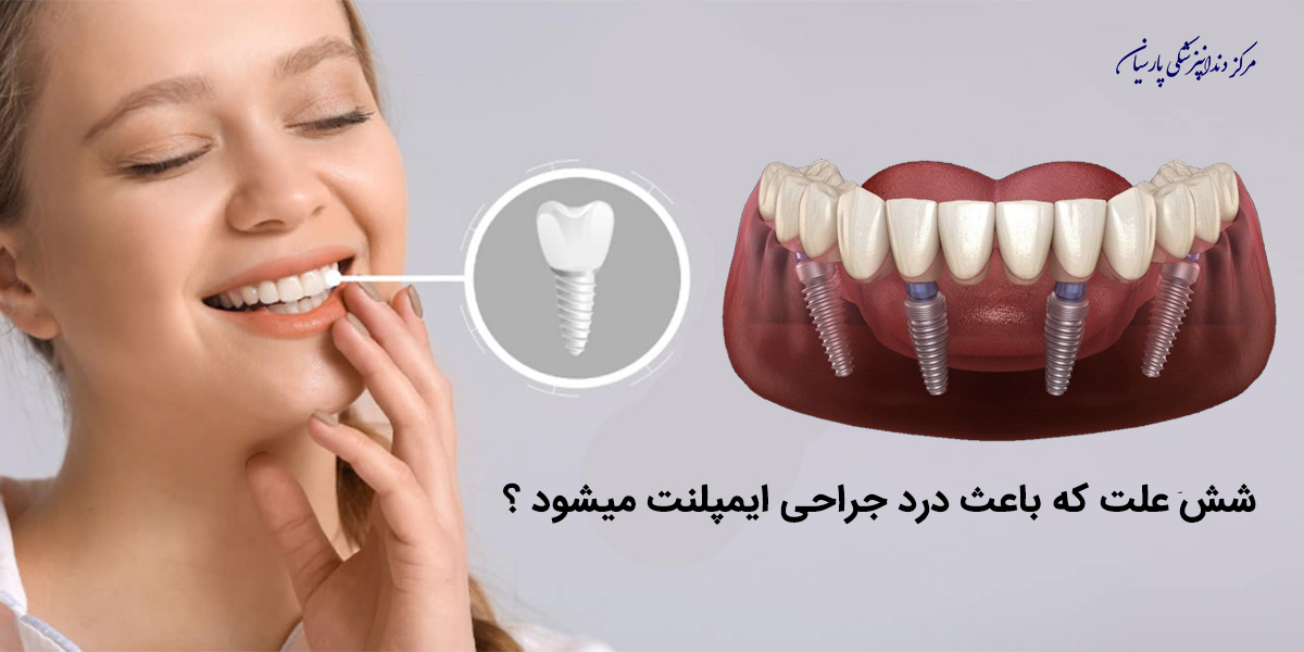 شش علت که باعث درد جراحی ایمپلنت میشود ؟
