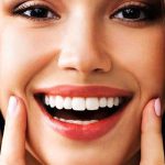 طرح لبخند هالیوودی چه نکات و ویژگی هایی دارد ؟