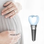 آیا انجام ایمپلنت در بارداری توصیه میشود ؟