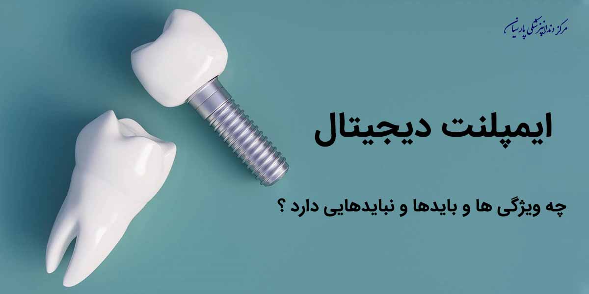 ایمپلنت دیجیتال چه ویژگی هایی دارد ؟