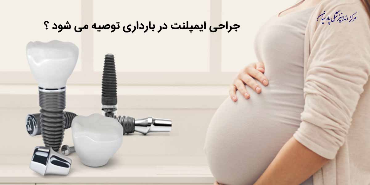 جراحی ایمپلنت در بارداری توصیه می شود ؟