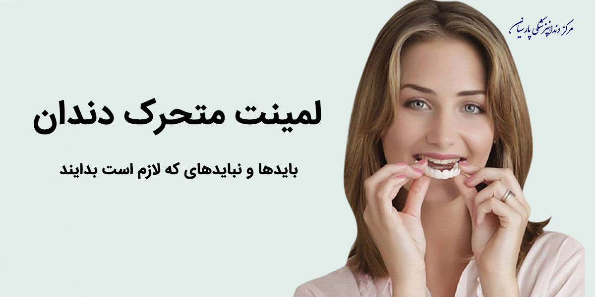 لمینت متحرک دندان چه ویژگی هایی دارد ؟
