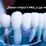 همه چیز در رابطه با ایمپلنت دیجیتال که باید بدانید