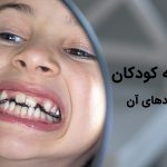 علت های دندان قروچه کودکان کدام است ؟