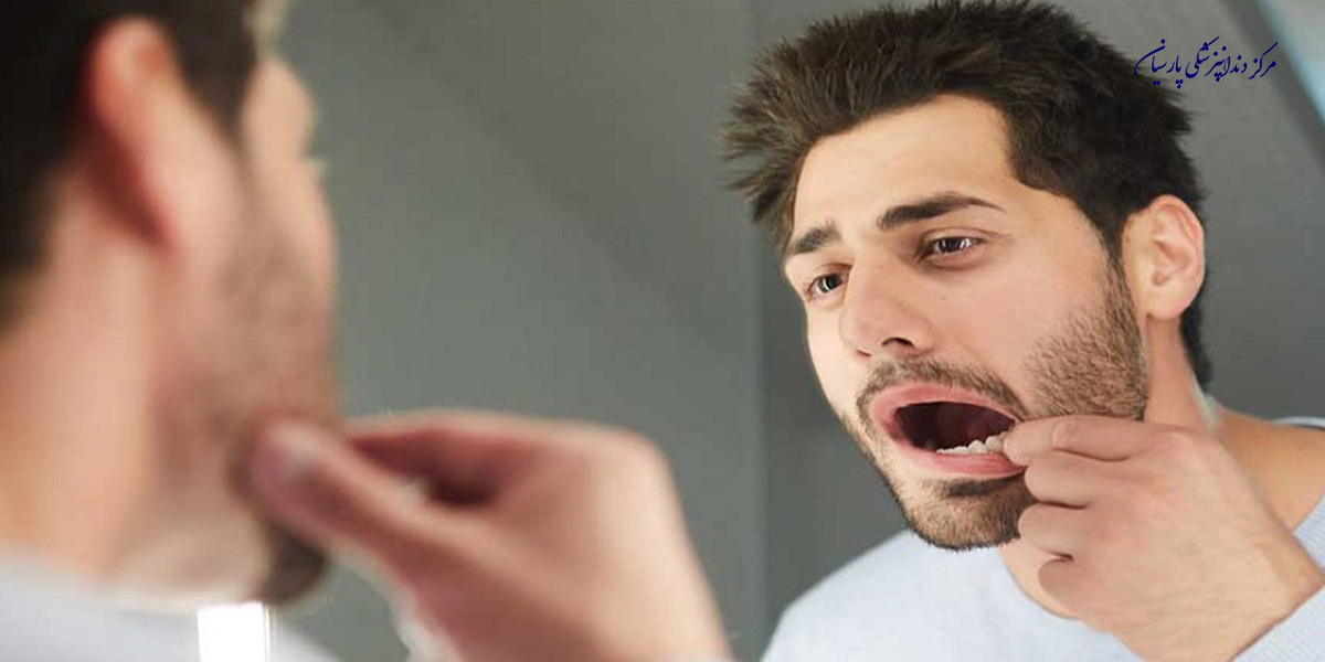 علل و عواملی که باعث لق شدن دندان در بزرگسالان میشود