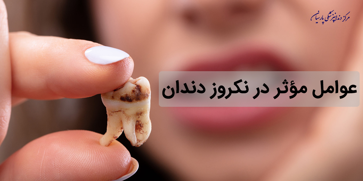 عوامل مؤثر در نکروز دندان کدام است