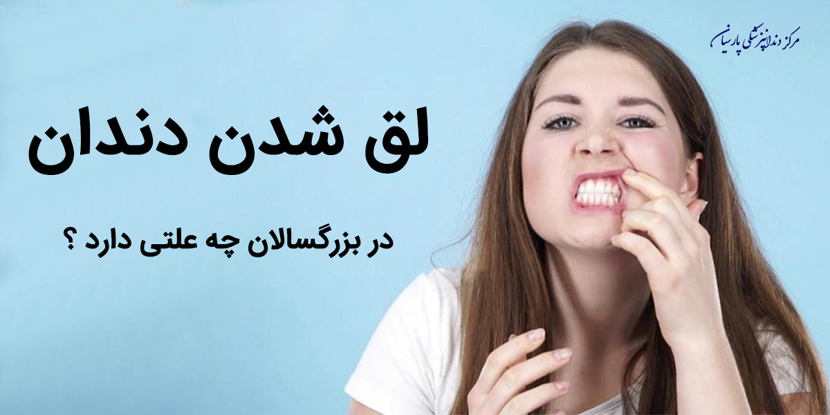 لق شدن دندان در بزرگسالان چه علتی دارد ؟