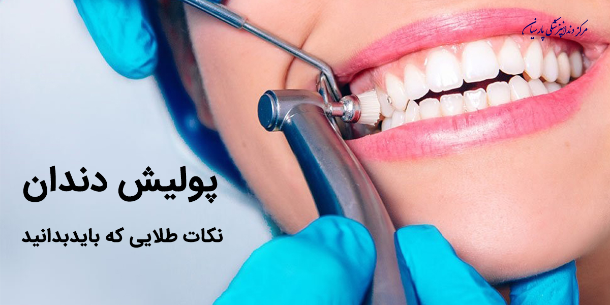 اهمیت پولیش دندان و نکاتی که در این مورد باید بدانید