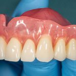 بایدها و نبایدهایی از دندان مصنوعی ژله ای که لازم است شما بدانید