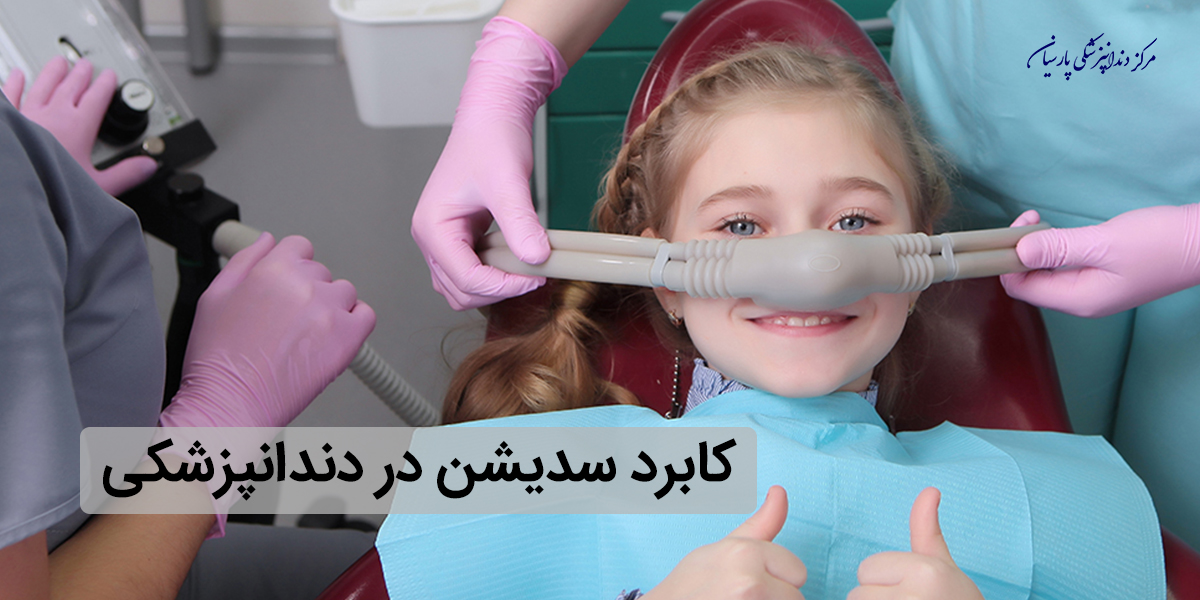 بایدها و نبایدهایی از سدیشن که لازم است بدانید