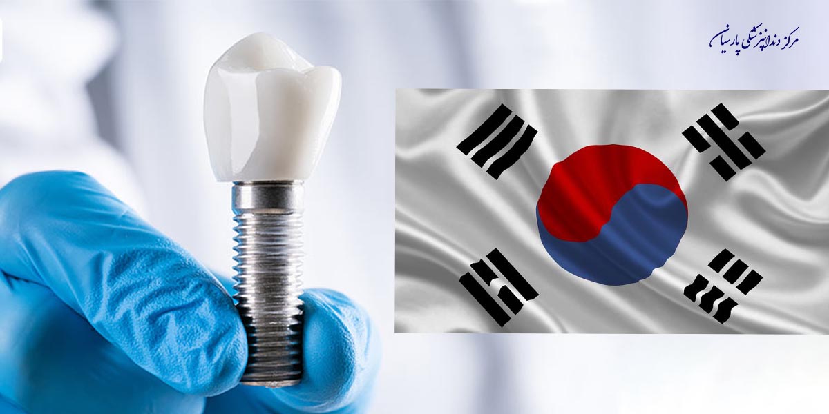 بایدهای و نبایدهایی از ایمپلنت کره ای که شما نمیدانید