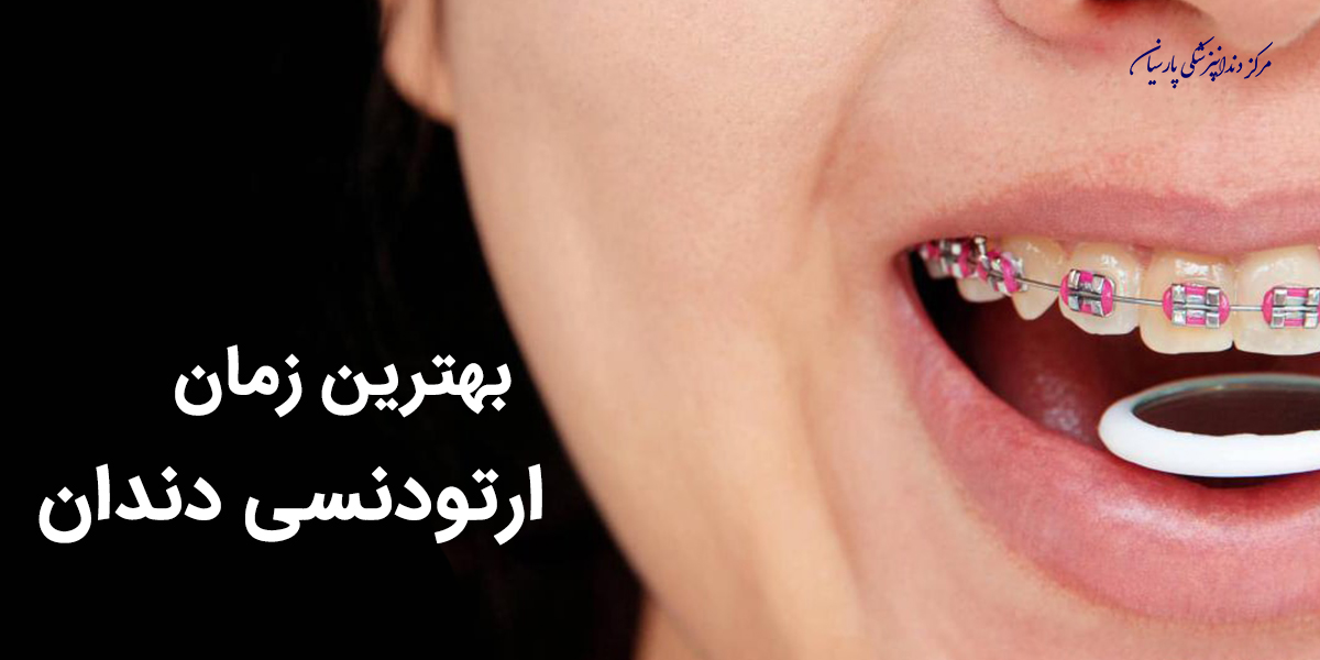 بهترین زمان ارتودنسی دندان کودکان که باید بدانید