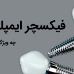 همه چیز در رابطه با فیکسچر ایمپلنت که باید بدانید