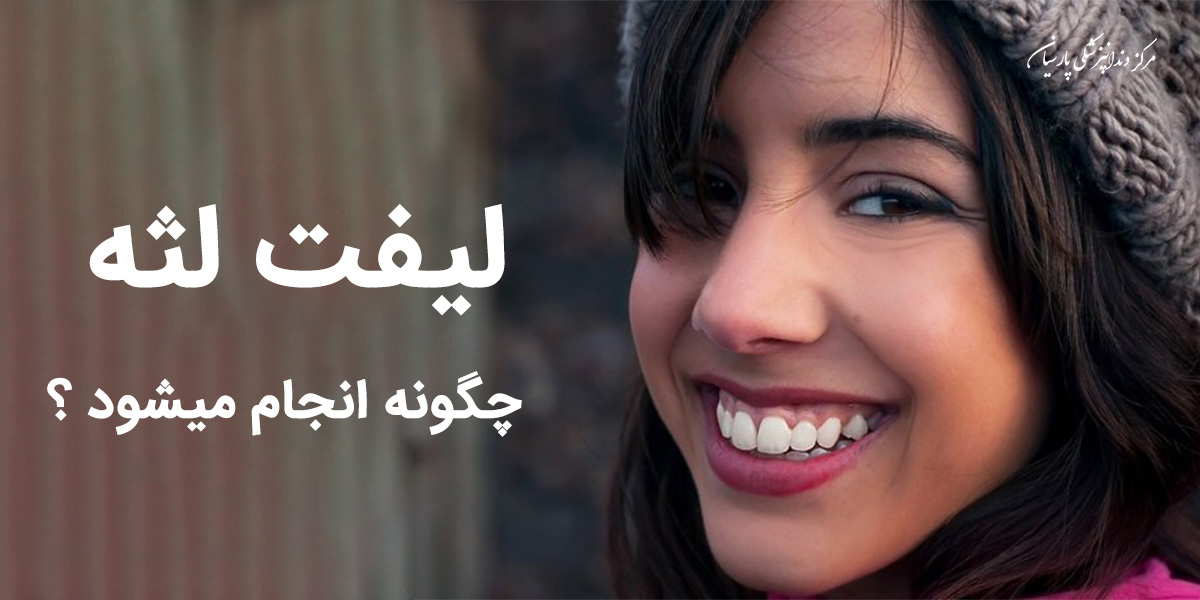 لیفت لثه یا ژنژیوکتومی چگونه انجام میشود ؟