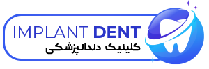 کلینیک دندانپزشکی ایمپلنت دنت | ایمپلنت دندان دیجیتال ،ایمپلنت دندان فوری،ایمپلنت اقساطی
