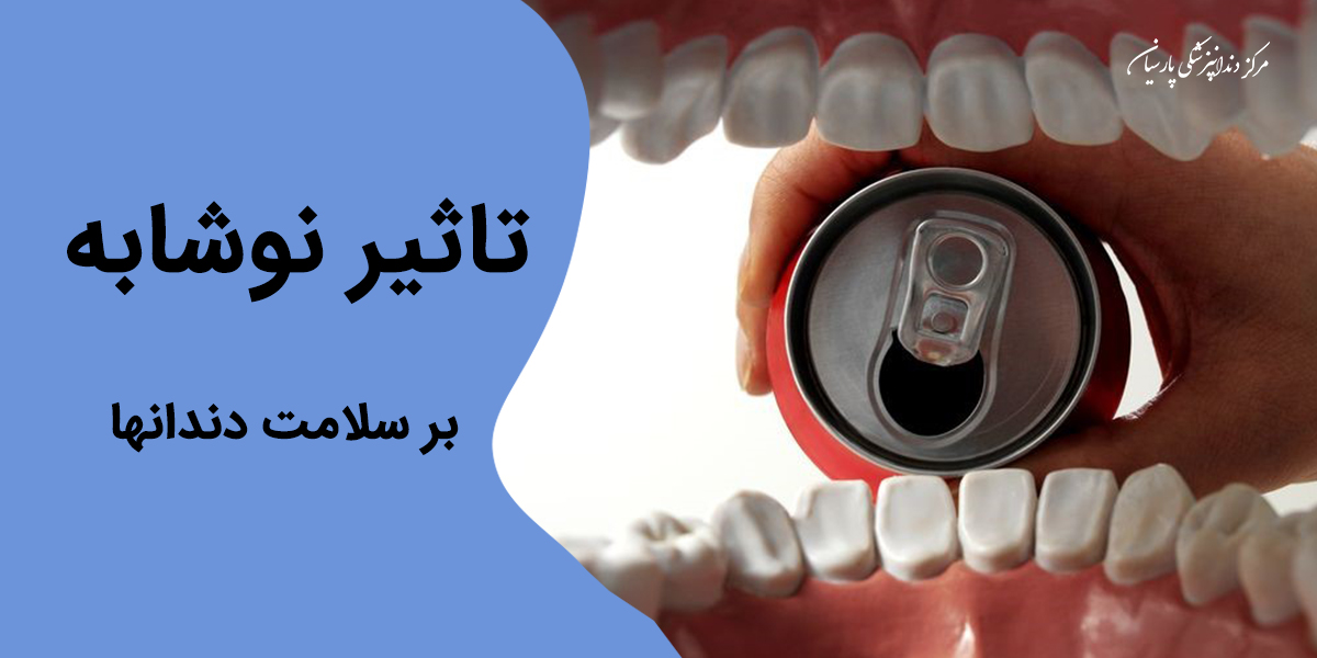 آیا نوشیدن نوشابه برای سلامتی دندان ها مضر است ؟