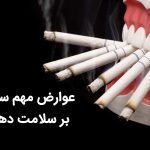 از عوارض سیگار کشیدن و رابطه آن با سلامت دندان چه میدانید ؟