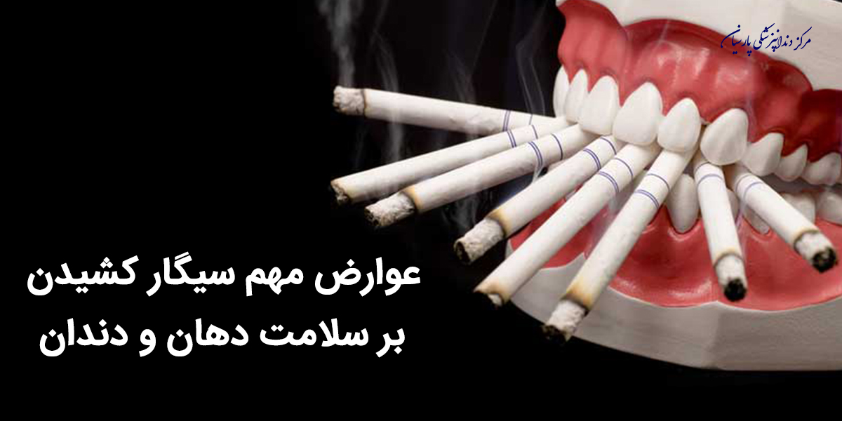 از عوارض سیگار کشیدن و رابطه آن با سلامت دندان چه میدانید ؟