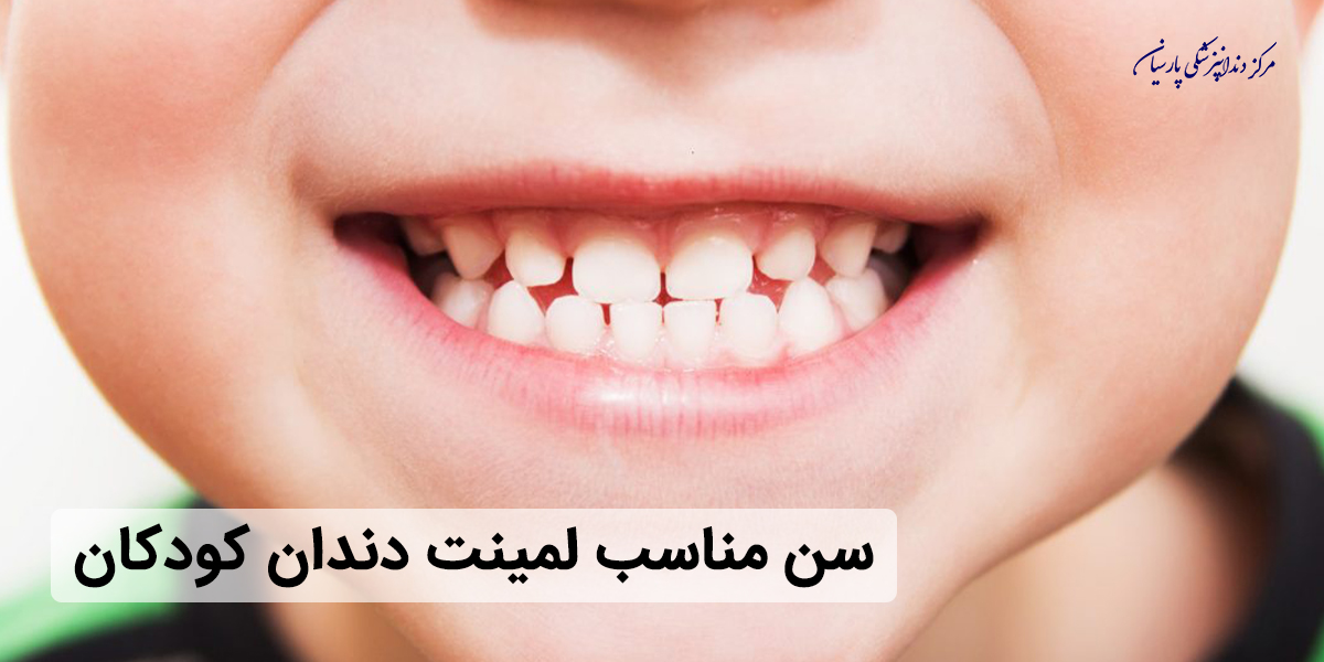 لمینت دندان کودکان از چه سنی انجام میشود ؟
