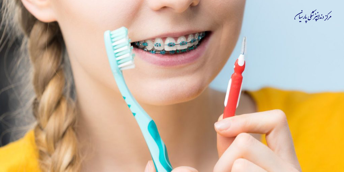 همه چیز در رابطه با مسواک ارتودنسی که باید بدانید