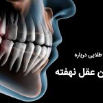 چرا جراحی دندان عقل نهفته مهم است ؟