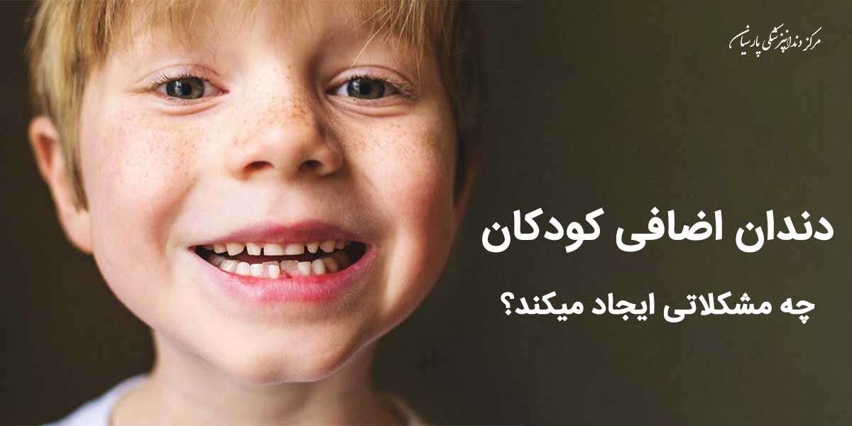 دندان اضافه کودکان چه مشکلاتی را با خود به همراه دارد ؟