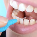 راه های پیشگیری از گیر غذایی کدام است ؟