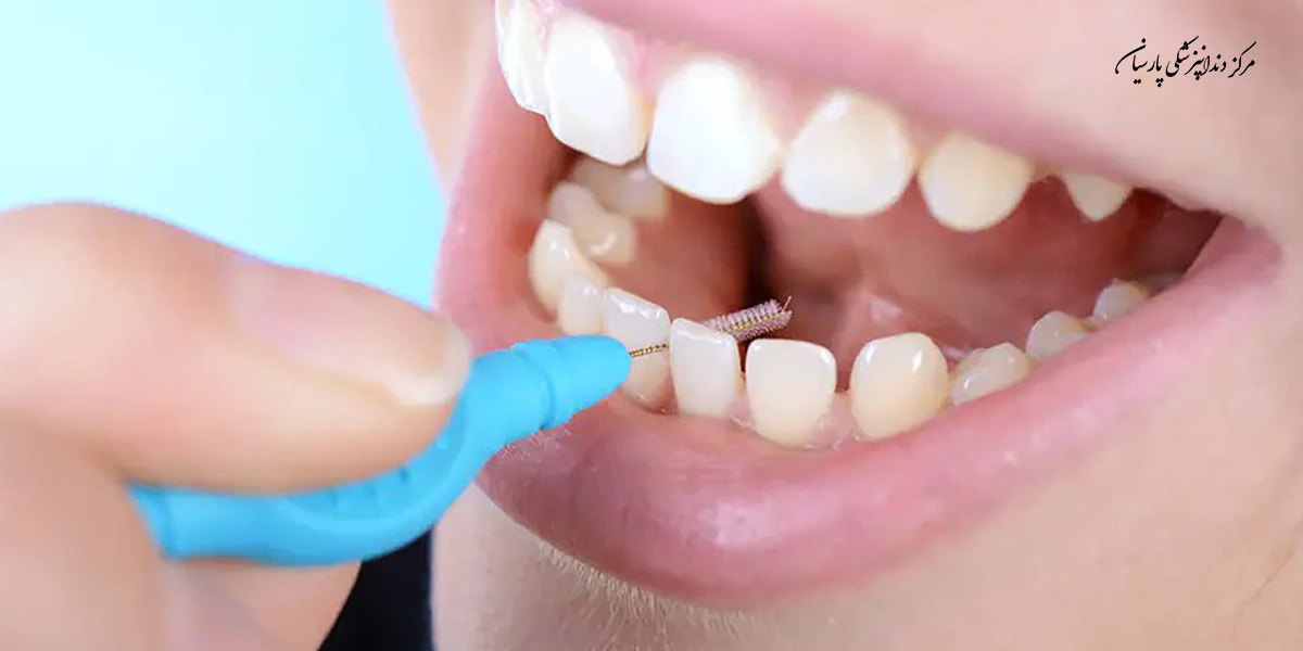 راه های پیشگیری از گیر غذایی کدام است ؟