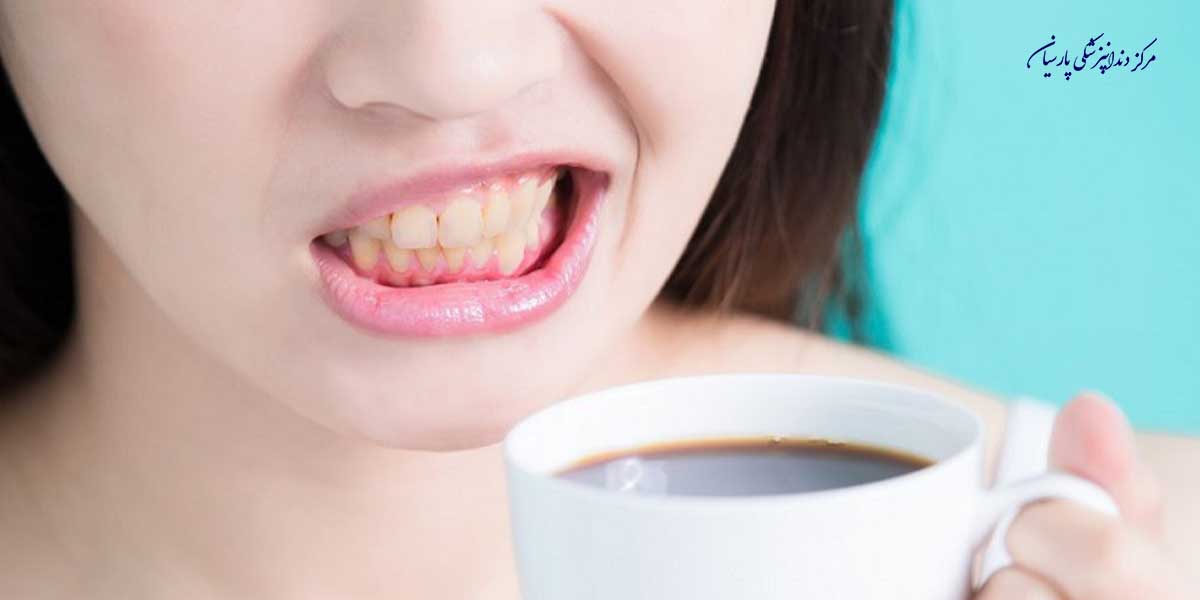 نوشیدن قهوه چه تاثیری بر تغییر رنگ دندان ها دارد ؟