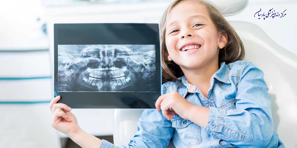 همه چیز در رابطه با دندان اضافه کودکان که باید بدانید