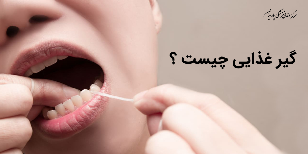 گیر غذایی در چه شرایطی ایجاد و راه درمان آن چیست ؟