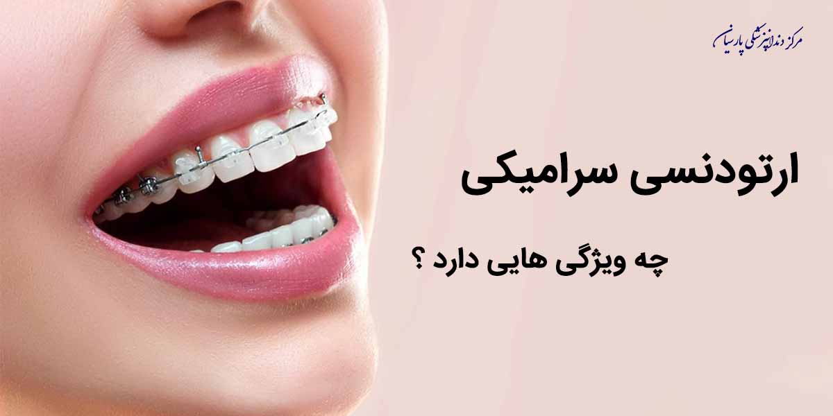 ارتودنسی سرامیکی چه ویژگی‌های مثبت و منفی دارد ؟