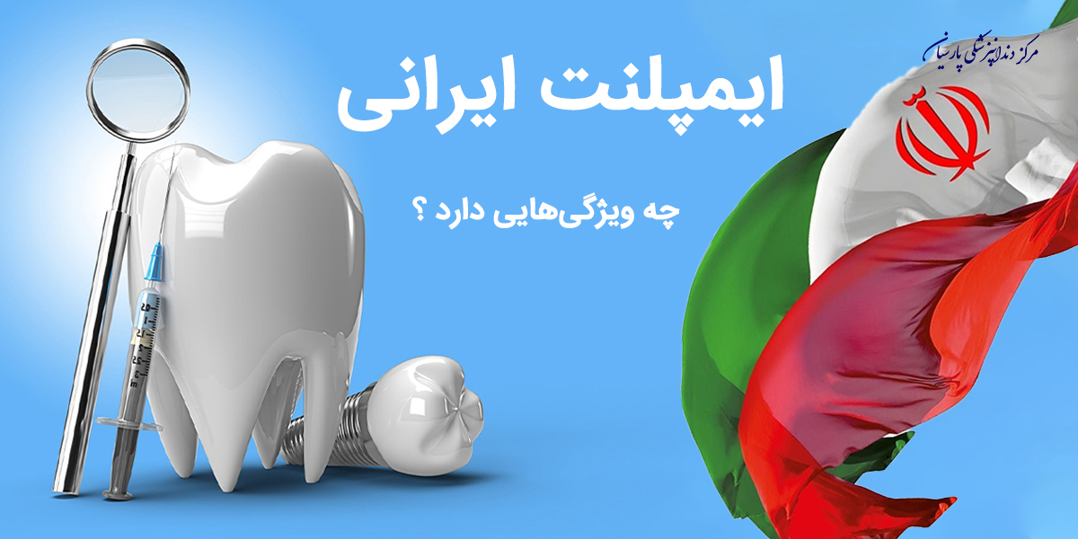 ایمپلنت ایرانی چه ویژگی ها و مشخصاتی دارد ؟