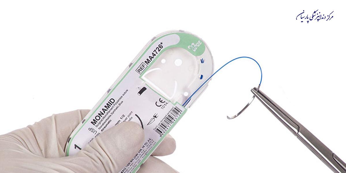 بایدها و نبایدهایی از اهمیت کیفیت نخ بخیه در جرای های دندانپزشکی