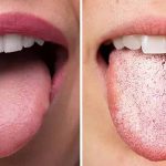 بایدها و نبایدهایی از علت سفیدی زبان که از آن آگاهی ندارید