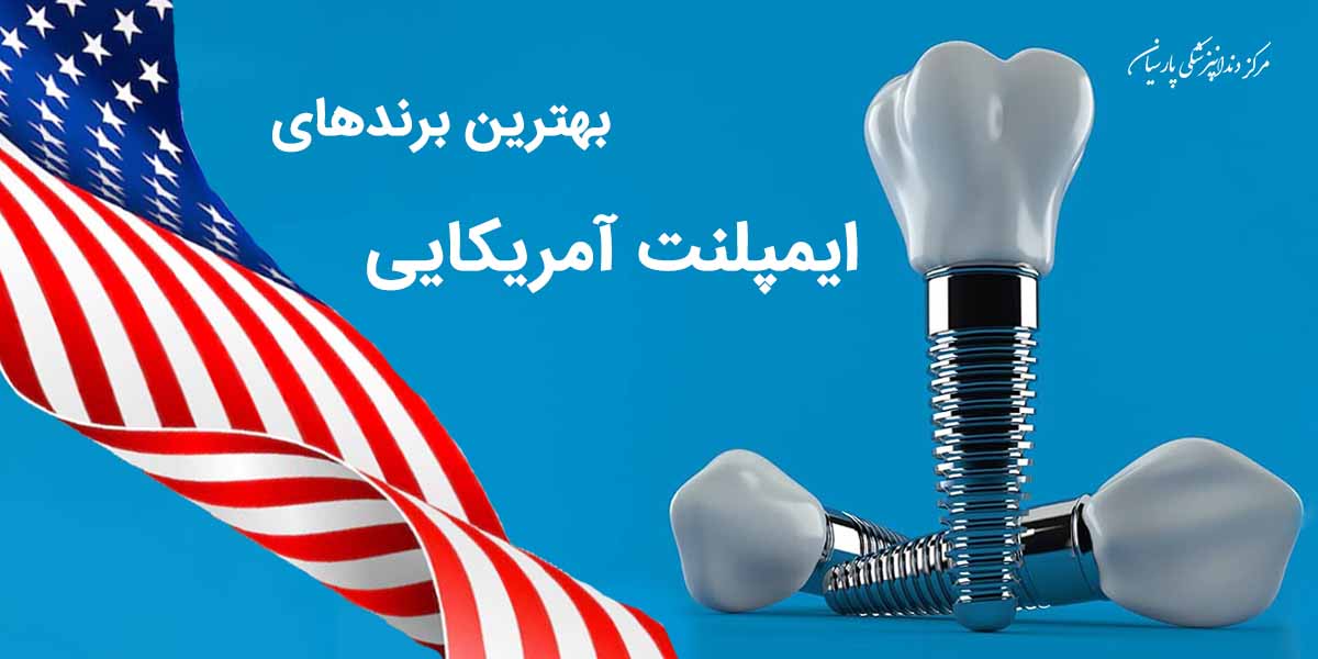 بهترین برندهای ایمپلنت آمریکایی کدام است ؟